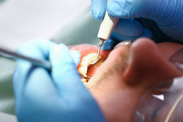 Best Urgent Tooth Repair  in Clarksville, TX