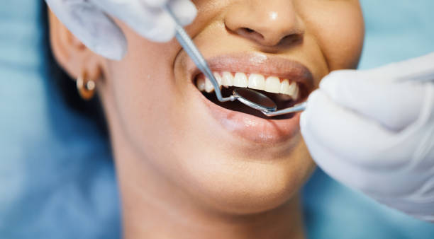 Best Emergency Tooth Extraction  in Clarksville, TX